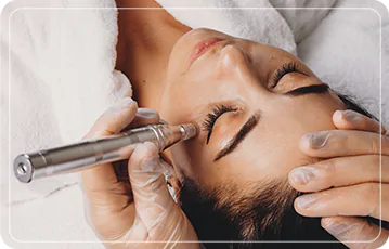Zen Balance - MICRONEEDLING
